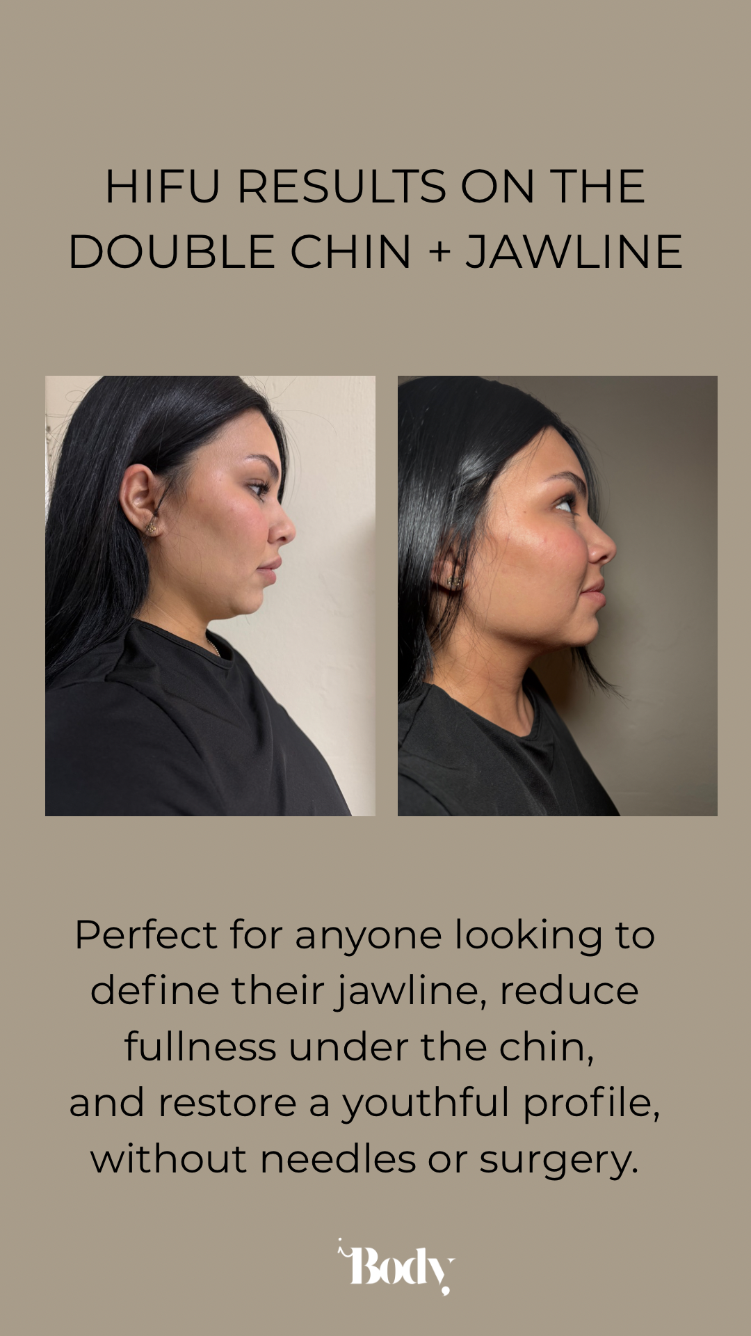 Skin Lift 3D Pro Jawline area